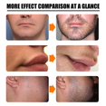 thumbnail image 5 of Aceite para el crecimiento de la barba de los hombres con Kit de rodillo potenciador nutritivo barba aceite Spray Anti pérdida de cabello mantenimiento esencia Spray, 5 of 5
