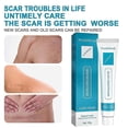 thumbnail image 2 of 2pcs 20g Scar Removing Cream Multipurpose Smoothing Smooth Skin Repairing Cream, 2 of 3