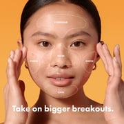 Hero Cosmetics Mighty Patch Face Multi-Blemish Hydrocolloid Acne Pimple Patch 5 Count