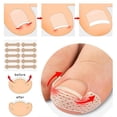 thumbnail image 5 of 15 PCS Toenail Care Kit with Breathable Nail Strips – Stainless Steel Nail Grooming Tools for Comfortable At-Home Nail Maintenance, 5 of 9