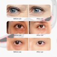 thumbnail image 5 of Revital Eyes Red Light Therapy Glasses, Advanced EMS Under Eye Massager, At Home Use Beauty Device Compatible with Dark Circles, Puffiness Fine Lines, 5 of 5
