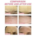 thumbnail image 2 of Anti Wrinkle Forehead Pad, Anti Wrinkle Patches, Frownies Facial Patches, Forehead Wrinkle Skin Moisturising 5Pieces/Box, 2 of 8