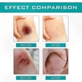 thumbnail image 3 of Protective Skin Film, Solution for Minor Wound Care, Barrier Against Surface Injuries, 3 of 5