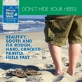 thumbnail image 4 of Miracle of Aloe Heel Stick-Gel Socks Combo, 2.5 Ounce Stick with Ultra-Aloe and Silicone Moisturizing Gel Heel Socks, 4 of 7