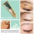 thumbnail image 3 of Crema para eliminar cicatrices quirúrgicas quemadas, Gel que se desvanece, reparación del acné, marcas de viruela, estrías, cicatriz de cesárea brillante, cuidado de la piel suave, 30g, 3 of 5