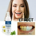 thumbnail image 3 of 7.5% Hydroxyapatite Toothpaste, Fluoride-Free Hydroxyapatite Toothpaste Whitening, 7.5% Nano Hydroxyapatite Toothpaste White Tooth Repair, Tooth Stren, 3 of 4