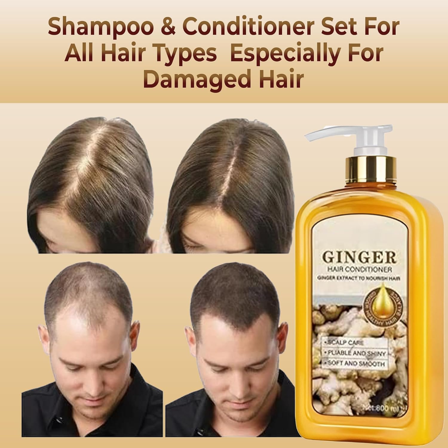 ABBASI & CO Anti-Hair Loss Shampoo & Conditioner Set - Ginger Plant Extract Instant Hair Growth Shampoo - Anti-Dandruff Care Formula - Oil Control & Hair Loss Treatments For women & Men - 2x 800 ML