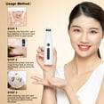 thumbnail image 2 of Amdohai Portable Blackhead Remover Electric Blackhead Suction Device with 6 Suction Probes and 5 Adjustable Suction Force 5PCs Acne Removing Tools -USB Rechargeable, 2 of 7