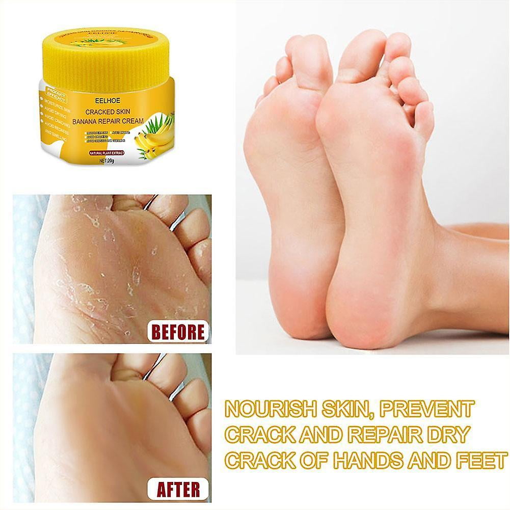 Heel crack remover deals