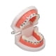 thumbnail image 5 of Modelo de dientes de tipodonto dental con soporte de metal de ortodoncia para la enseñanza de dentistas, investigación y laboratorio dental, 5 of 15