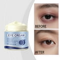 thumbnail image 4 of Upgraded 2026 Eye Balm Cream To Dilute Eye Bags To Fine Lines Moisturize And Tighten The Eyes 100g, 4 of 7