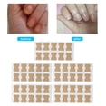 thumbnail image 1 of Parche Para Uñas De Los Pies, Salud Higiénica Sin Pegamento, 50 Piezas De Parche Para Uñas Encarnadas, Diseño Compacto Para Excursiones Para El Cuidado De Los Pies, 1 of 7