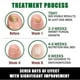 thumbnail image 5 of 30ml Nails Care Repair Nail Fungal Anti-fungus Onychomycosis-removal Liquid Ginger Foot Antifungal Nail Treatments, 5 of 5