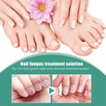 thumbnail image 2 of Solución Reparadora De Uñas Grises Solución De Reparación De Uñas Gris 30Ml Esencia De Eliminación De Hongos En Las Uñas Cuidado De La Reparación Del Cuidado De Los Pies Ndcxsfigh Cuidado Belleza, 2 of 4
