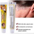 thumbnail image 5 of Psoriasis Ointment, Eczema Cream Psoriasis Antipruritic Ointment Dermatitis Eczematoid Inhibit Bacteria Antibacterial Cream 20g, 5 of 5