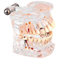 thumbnail image 4 of New Dental Teaching Study Standard Tooth Model Demonstration Disease Educational, 4 of 4