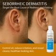 thumbnail image 5 of CLINITY Psoriasis & Eczema Shampoo, Hair & Scalp Treatment with Copper, Honey, and Coptis, 12 fl oz, 5 of 9