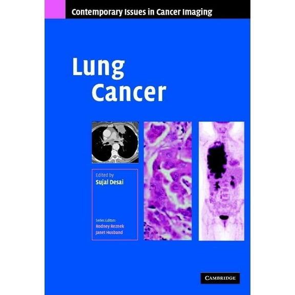 Contemporary Issues in Cancer Imaging Lung Cancer, (Hardcover)