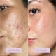 thumbnail image 3 of Spray facial Tower 28 SOS Daily Rescue para piel sensible, 30 ml, 3 of 9