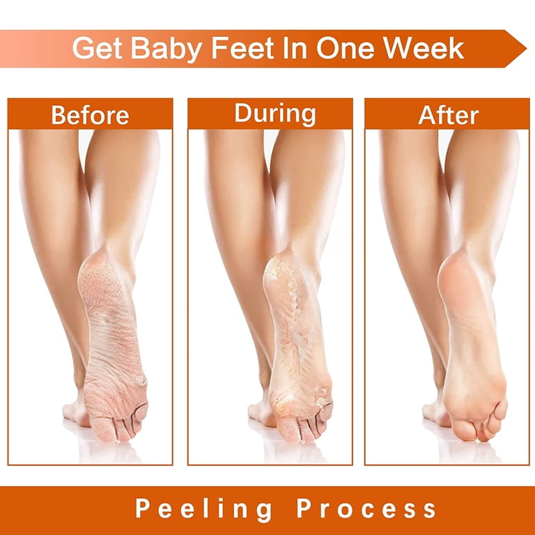 Baby Feet Peel