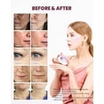 thumbnail image 4 of Parches de gel para ojos K-SECRET Advanced Regeneration, 60 unidades con RETINOL, 4 of 8
