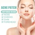 thumbnail image 5 of Acne Pimple Patches, 8 Sizes 102 Patches For Large Zit Breakouts, Acne Patches For Face, Chin Or Body, Hydrocolloid Bandages Acne With Tea, 5 of 5