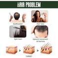 thumbnail image 3 of Ginger Hair Growth Spray, Fortaleceder de Cabello Spray de Jengibre 3pcs Extracto de Hierbas Hidratante para la Vida Diaria, 3 of 7