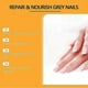 thumbnail image 3 of Bee Venom Nail Treatment Solution, Bee Venom Nail Fungus Treatment, Extra Strength Nail Repair Solution, Nail Fungus Care Spray, 3 of 5