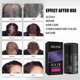 thumbnail image 5 of Hair Fibres - 100% Natural Cotton Powder Hair Microfibers to Instantly Conceal Baldness and Alopecia - Hair Fiber Men and Women - Hair Fibers Densifyi, 5 of 5
