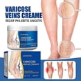 thumbnail image 2 of Varicose Vein Cream 50g Varicose Vein Cream Anti-spider And Vein Removal Varicose Leg Care high quality nice, 2 of 4
