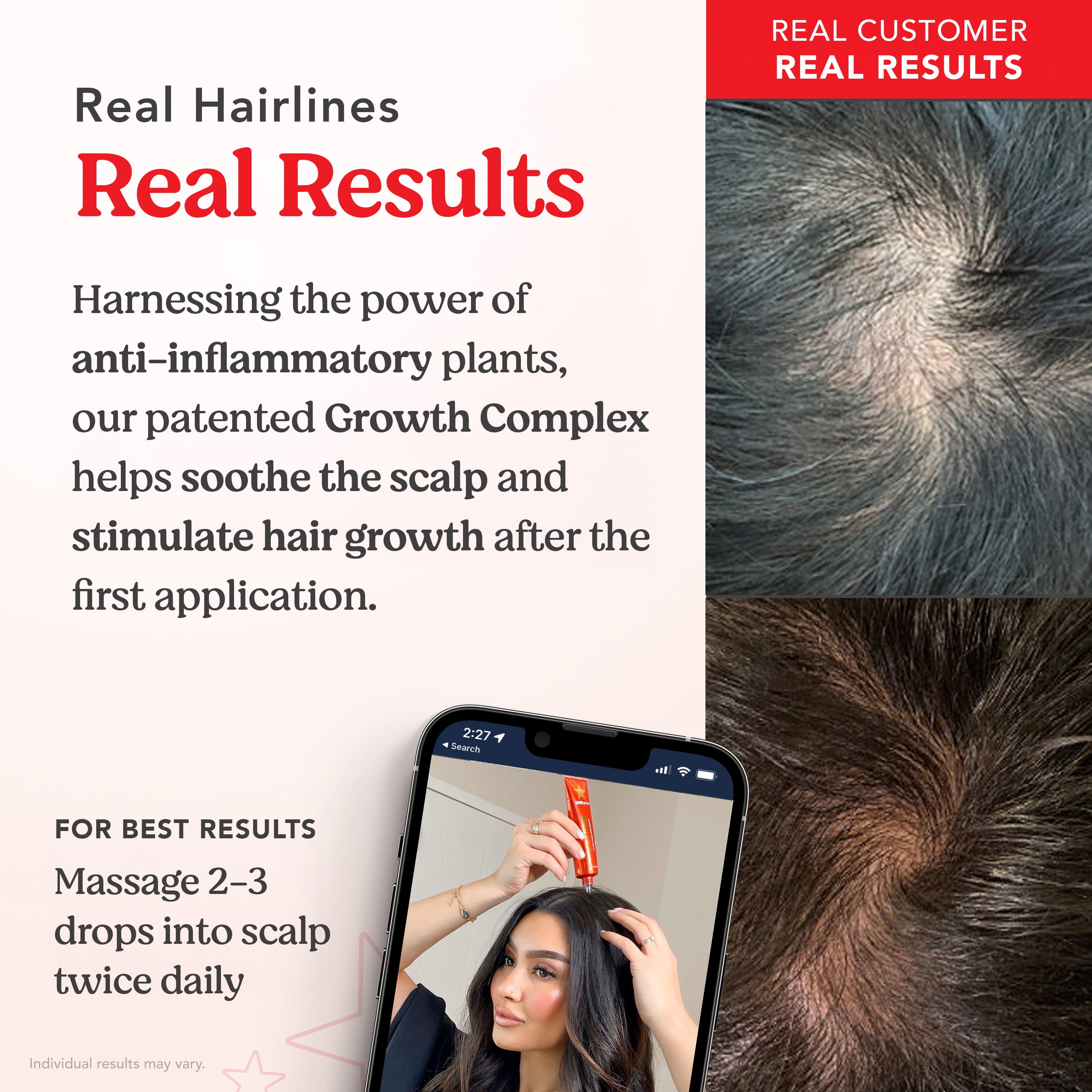 HAIRtamin Scalp Serum Hair Growth and Thickening Treatment, Nourishes Dry Itchy Scalp, 2 fl oz