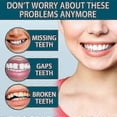 thumbnail image 2 of EELHOE adjustable snap-on dentures, modified teeth, gap filling, braces, orthodontic, 2 of 4