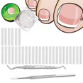 thumbnail image 1 of (30+2) Paquete de kit de tratamiento de corrección de uñas encarnadas, 30 tiras correctoras de uñas encarnadas, herramienta de pedicura para uñas encarnadas, parche de corrección de uñas con 2 levanta, 1 of 5