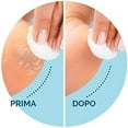 thumbnail image 4 of Electric Foot File Foot Callouses Dead Skin Remover Shaver Foot Care Tool Remove Dry Dead Hard Cracked Skin Safe And Painless, 4 of 4
