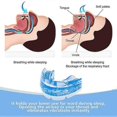 thumbnail image 5 of Anti-Snoring Mouthpiece Device Teeth Bruxism Sleeping Apnea Bruxism Snoring Mouth Guard Improve Sleep Braces Teeth Orthodontic, 5 of 5