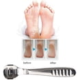 thumbnail image 4 of Foot Care Pedicure Callus Shaver, Stainless Steel Foot Callus Remover,Heel Razor Callus Shaver Sets, 4 of 4