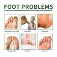thumbnail image 3 of 1pair Japan Foot Peeling Mask: Deal USSY X9C9, 3 of 6