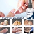 thumbnail image 4 of 30ml Anti-Fungal Nail Spray, Deep Repair & Natural Ingredients Nail Care Spray For Men & Women, 4 of 5