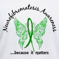 thumbnail image 3 of CafePress - Neurofibromatosis Butterfly Women's V Neck T Shirt - Womens Cotton V-Neck T-shirt, 3 of 4