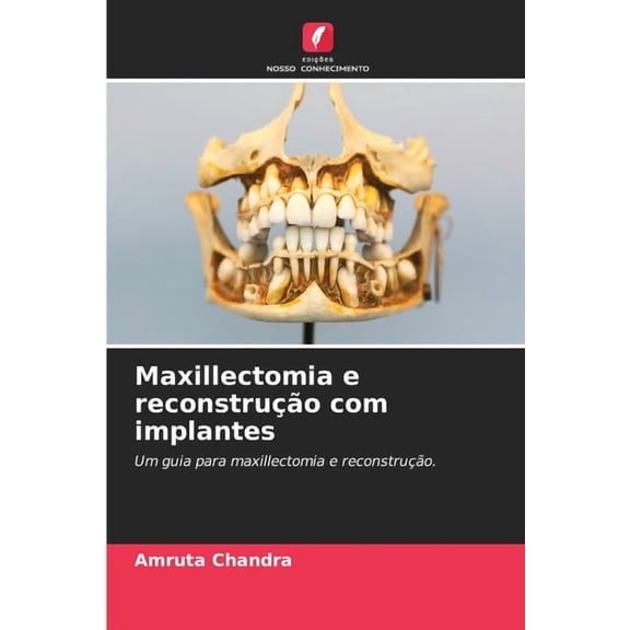 Maxillectomia e reconstruÃ§Ã£o com implantes, (Paperback)