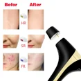 thumbnail image 2 of Depiladora láser IPL para uso doméstico, dispositivo de depilación permanente IPL, luz pulsada intensa e indolora de hielo, 3 cabezales, 900000 Flashes, 2 of 5