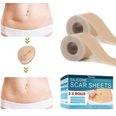 MuzooyBeauty Silicone Scar Sheets 2 Rolls, Burn Scars C-Section, Medical Grade Silicone Scar Tape Scar Removal Strips for Acne
