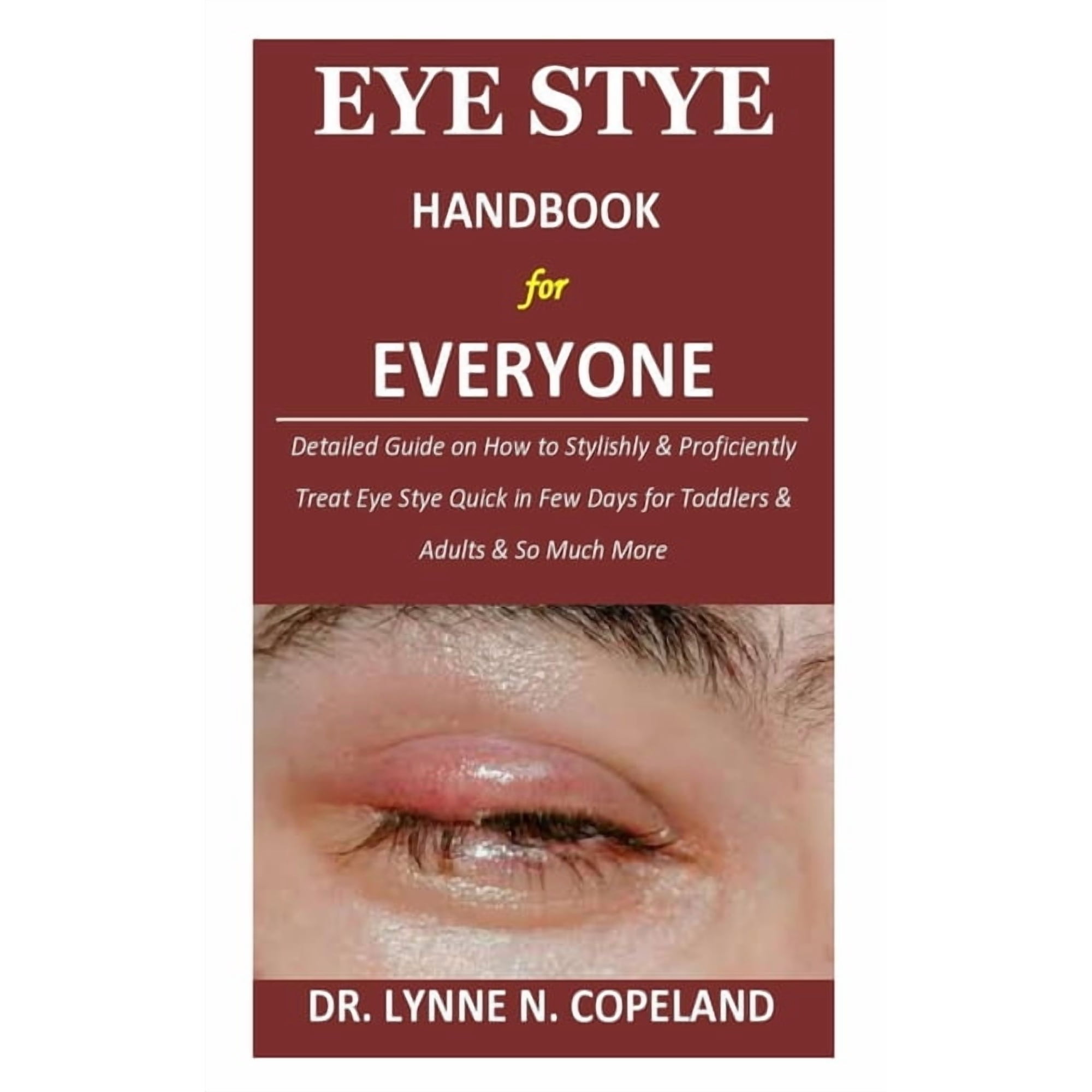 Dr Lynne N Copeland: Eye Stye Handbook for Everyone, Book 1 (Paperback)