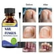 thumbnail image 1 of Fungal Nail Treatment - 30ml Extra Strong Nail Fungus Treatment for Toenail - Anti Fungus Nail Repair and Strengthen, 1 of 5