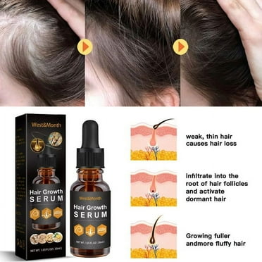 Hair Growth Serum for Black Women with Chebe, Allurium Beauty Hair Growth Oil, Natural Product Formul for Revitalize Hair Fast Regrowth, Anti-hair Loss & Thinning, Repair Damaged Hair