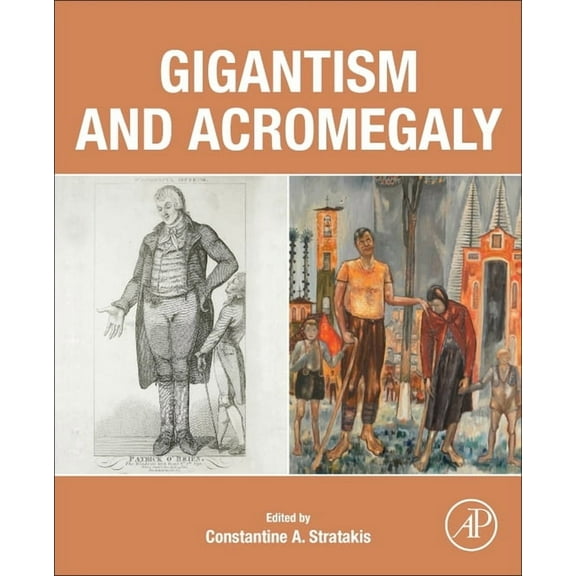 Gigantism and Acromegaly, (Paperback)