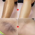 thumbnail image 4 of Gel depilatorio MEDIPICKME Touch-Up para zona bikini 150 ml, 4 of 7