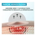 thumbnail image 4 of Pimple patch Garnier skincare pure active 22 pzas, 4 of 5