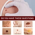 thumbnail image 4 of Uso fácil del extracto natural de la crema del retiro del defecto 3ml para el tratamiento Yeso médico Ehuebsd Cuidado Belleza, 4 of 6