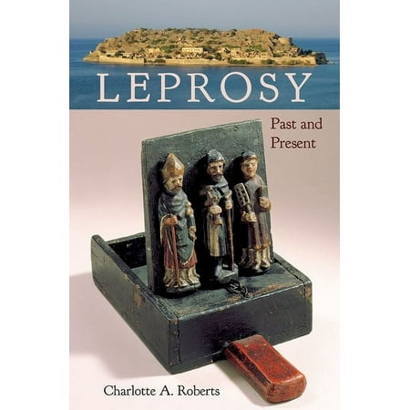 UPC: 9781683401841 | Bioarchaeological Interpretations of the Human Past: Local : Leprosy : Past and Present (Hardcover)